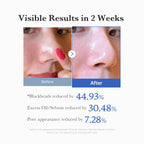 Medicube Zero Pore Pad 2.0