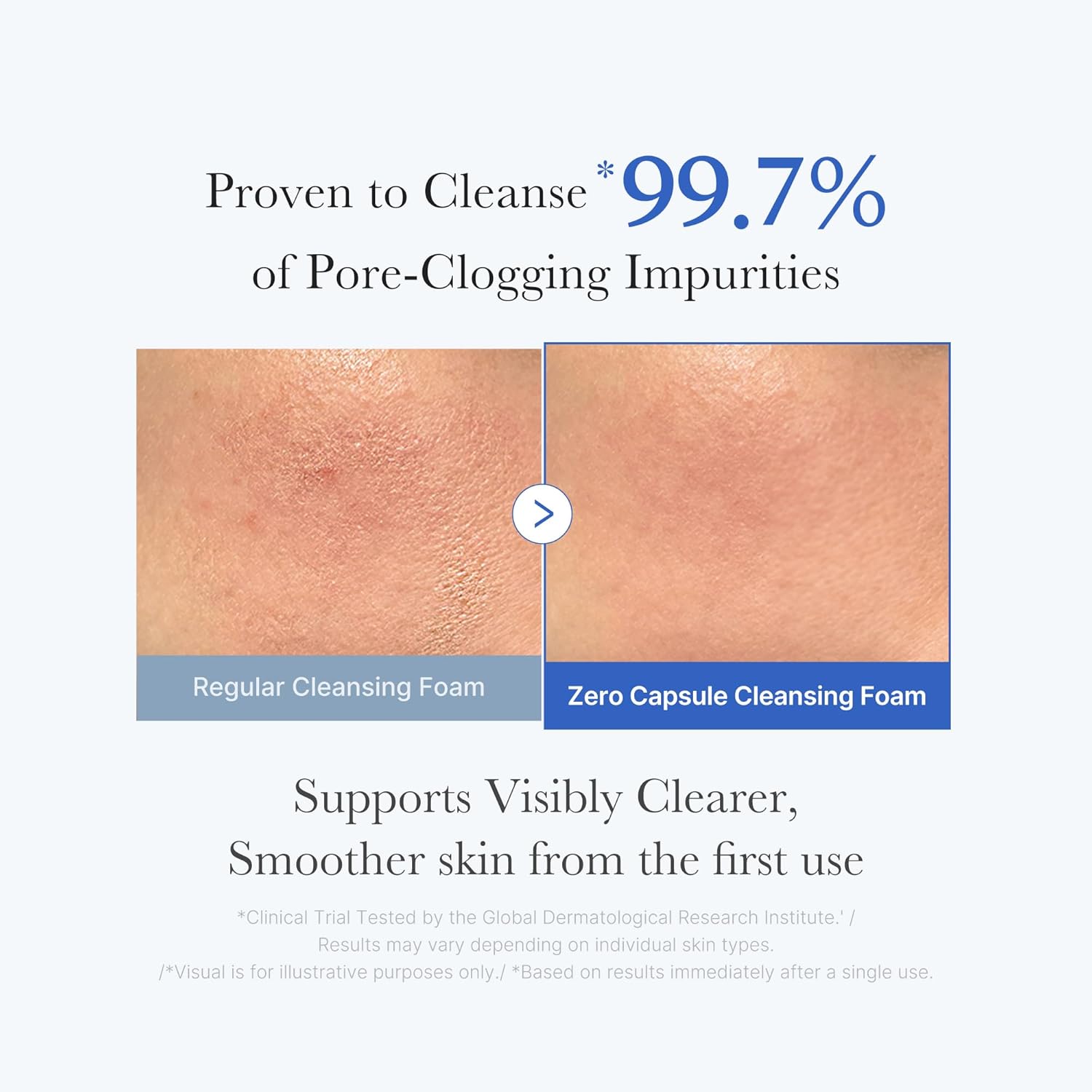 Medicube Zero Pore Capsule Cleansing Foam 120ml